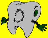 Coloring page Tooth with tooth decay painted byluca