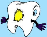 Coloring page Tooth with tooth decay painted bynicole