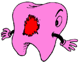 Coloring page Tooth with tooth decay painted bygenesis