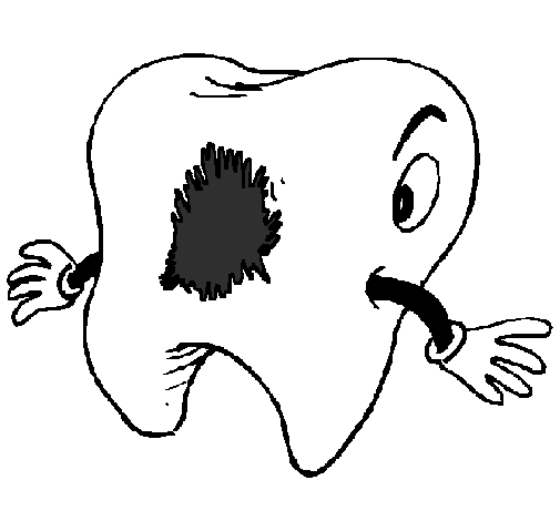 Tooth with tooth decay
