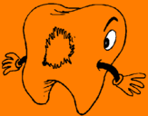 Coloring page Tooth with tooth decay painted by vgfig ggwpohsgdfdg   bru