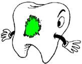 Coloring page Tooth with tooth decay painted byTay
