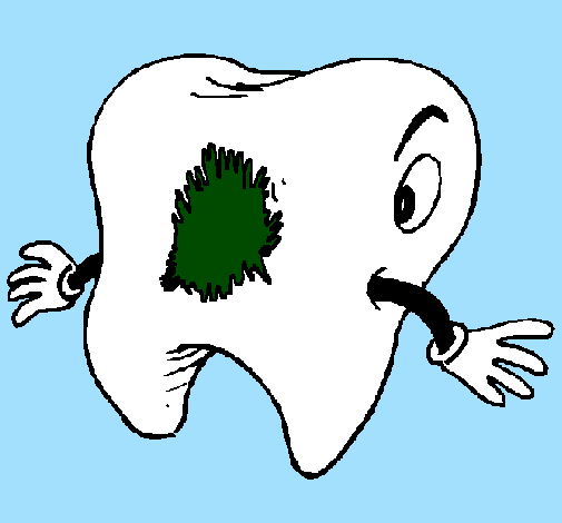 Tooth with tooth decay