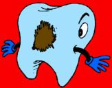 Coloring page Tooth with tooth decay painted byale       