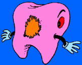Coloring page Tooth with tooth decay painted bypipe
