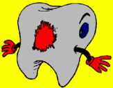 Coloring page Tooth with tooth decay painted by**ika**