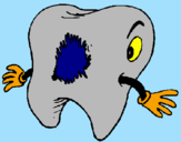 Coloring page Tooth with tooth decay painted byJonas