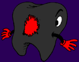 Coloring page Tooth with tooth decay painted bygreis