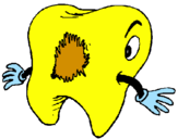 Coloring page Tooth with tooth decay painted bysandy